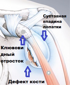 Клювовидный отросток Суставная впадина лопатки