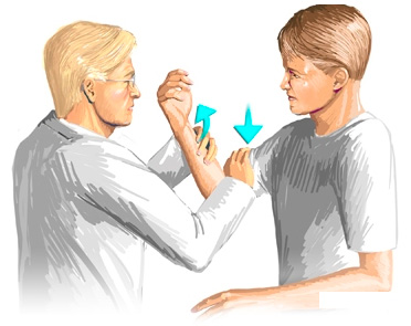Повреждение Банкарта, тест Проверка нестабильности сустава