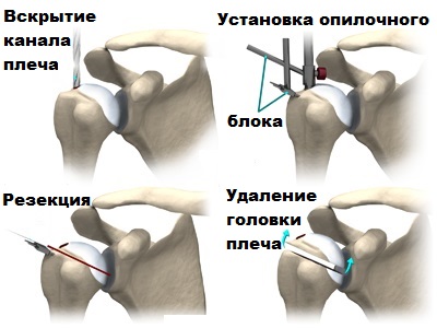 установка опилочного блока