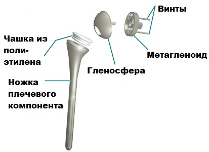 реверсивный эндопротез