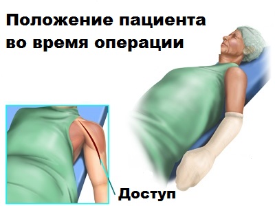 положение пациента во время операции