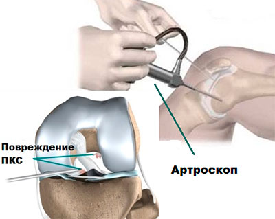 Барнаул суставы операция