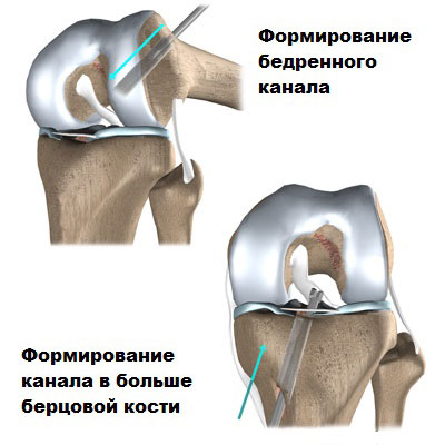 Каналы